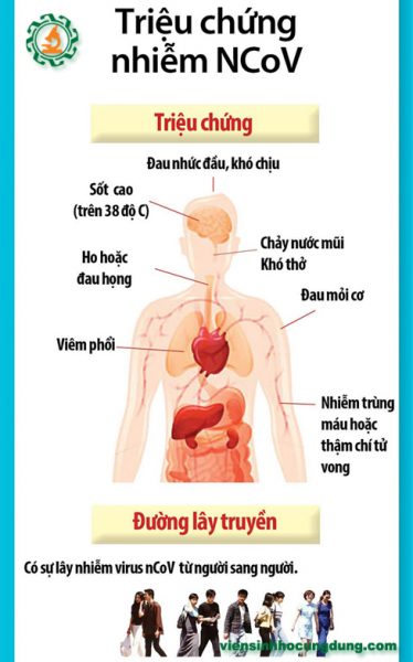 Các triệu chứng khi nhiễm virus nCoV là gì?