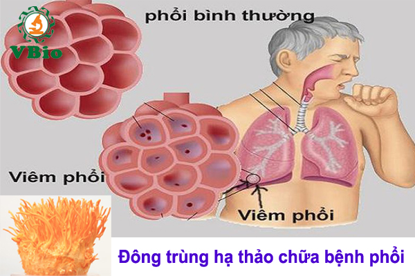 Đông trùng hạ thảo chữa bệnh phổi
