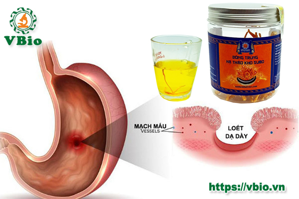 Cách chữa bệnh dạ dày bằng đông trùng hạ thảo